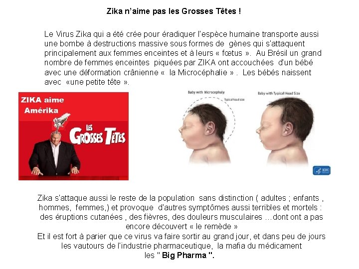 Zika n’aime pas les Grosses Têtes ! Le Virus Zika qui a été crée