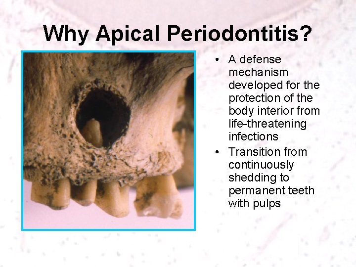 Why Apical Periodontitis? • A defense mechanism developed for the protection of the body