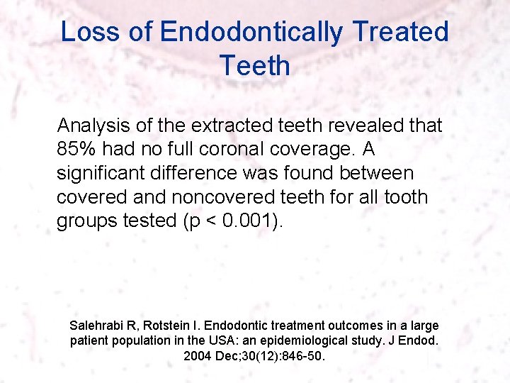 Loss of Endodontically Treated Teeth Analysis of the extracted teeth revealed that 85% had