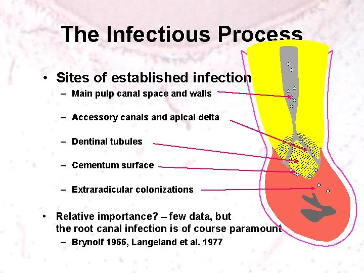 The Infectious Process • Sites of established infection – Main pulp canal space and