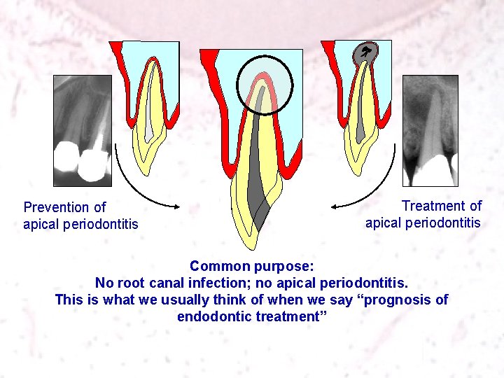 Prevention of apical periodontitis Treatment of apical periodontitis Common purpose: No root canal infection;
