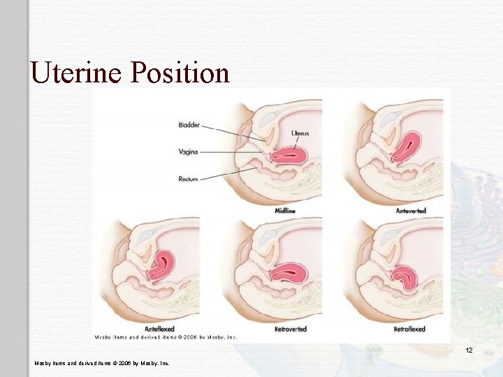 Uterine Position 12 Mosby items and derived items © 2006 by Mosby, Inc. 