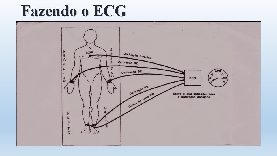 Fazendo o ECG 