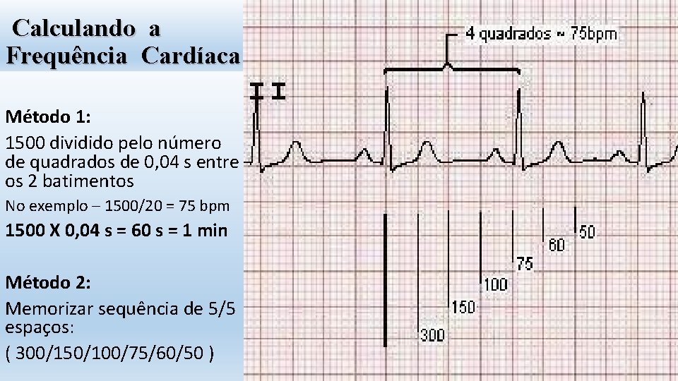 Calculando a Frequência Cardíaca Método 1: 1500 dividido pelo número de quadrados de 0,