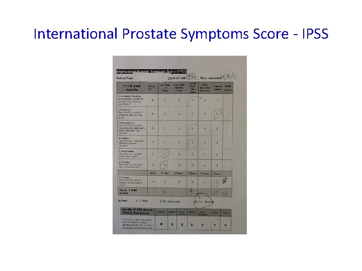 International Prostate Symptoms Score - IPSS 