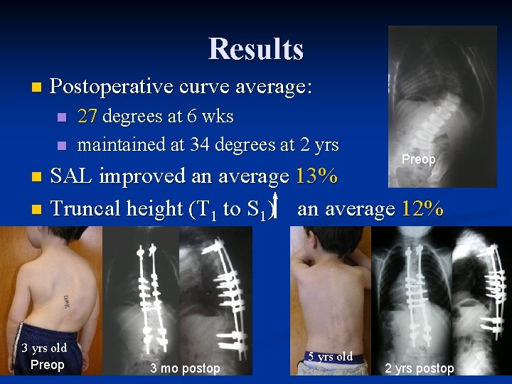 Results n Postoperative curve average: n n 27 degrees at 6 wks maintained at