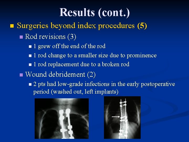 Results (cont. ) n Surgeries beyond index procedures (5) n Rod revisions (3) n