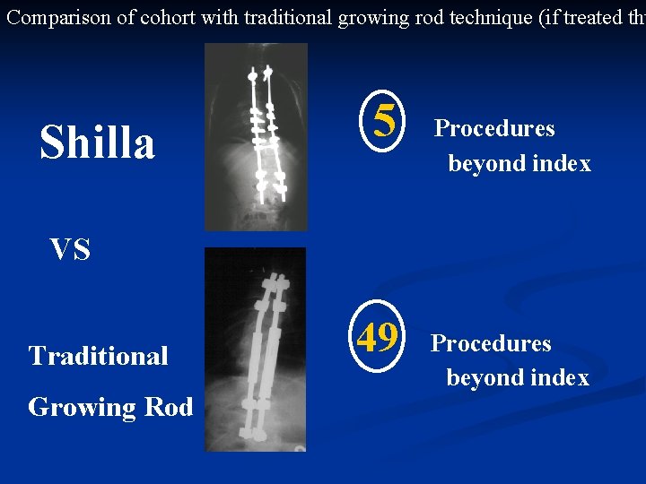 Comparison of cohort with traditional growing rod technique (if treated thu Shilla 5 Procedures