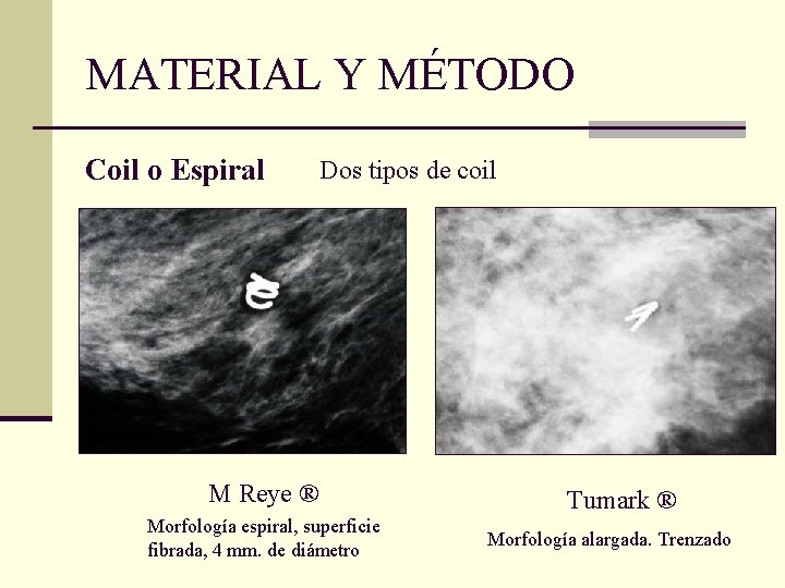 MATERIAL Y MÉTODO Coil o Espiral Dos tipos de coil M Reye ® Morfología