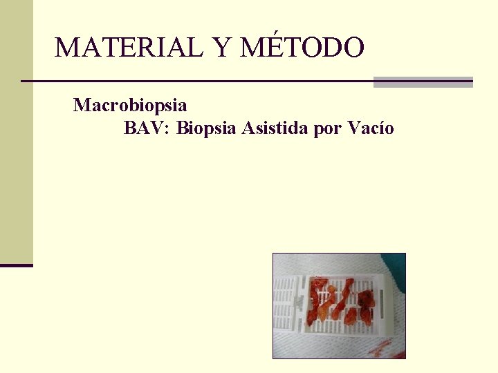 MATERIAL Y MÉTODO Macrobiopsia BAV: Biopsia Asistida por Vacío 