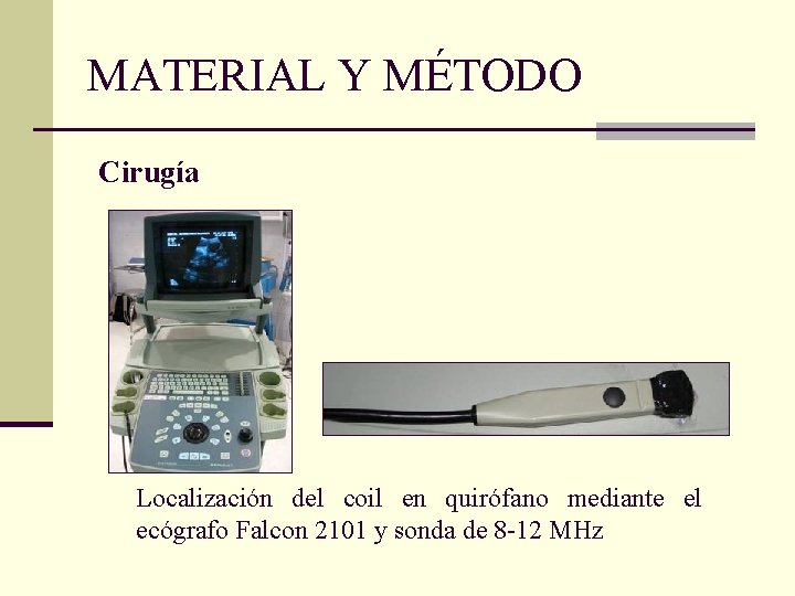 MATERIAL Y MÉTODO Cirugía Localización del coil en quirófano mediante el ecógrafo Falcon 2101