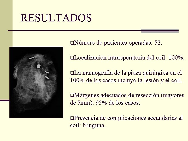 RESULTADOS q. Número de pacientes operadas: 52. q. Localización intraoperatoria del coil: 100%. q.