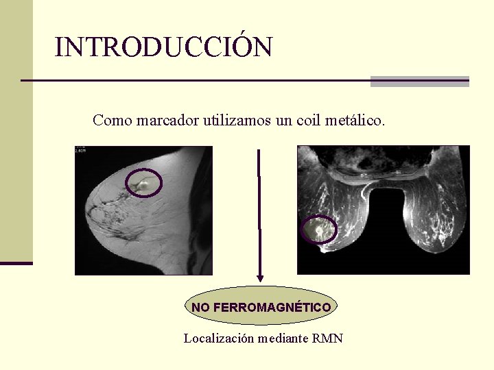 INTRODUCCIÓN Como marcador utilizamos un coil metálico. NO FERROMAGNÉTICO Localización mediante RMN 