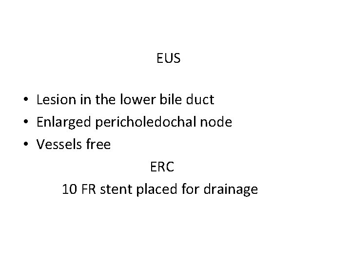 EUS • Lesion in the lower bile duct • Enlarged pericholedochal node • Vessels