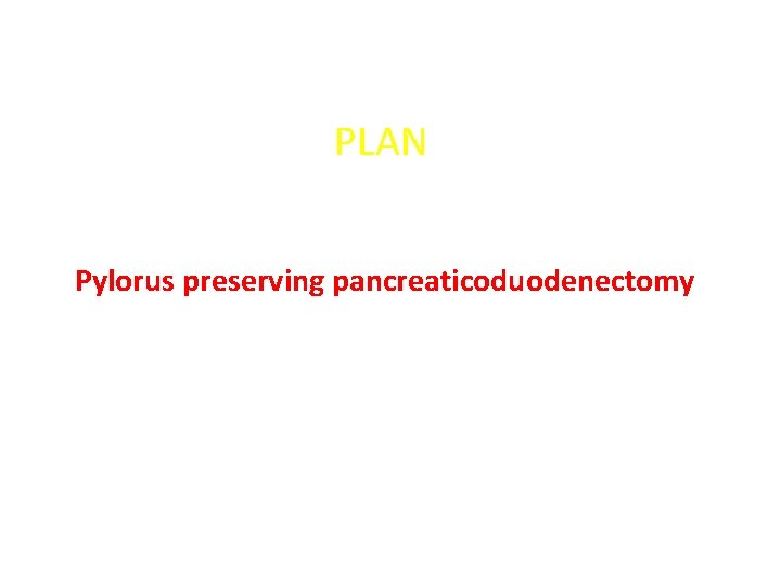 PLAN Pylorus preserving pancreaticoduodenectomy 
