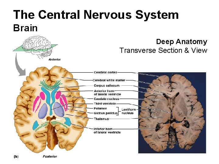 The Central Nervous System Brain Deep Anatomy Transverse Section & View 