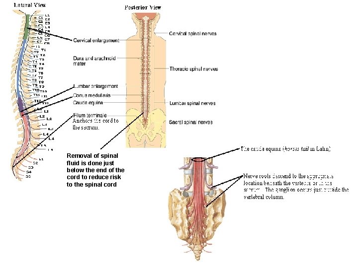 Removal of spinal fluid is done just below the end of the cord to