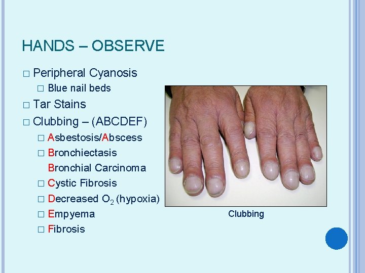 HANDS – OBSERVE � Peripheral Cyanosis � Blue nail beds Tar Stains � Clubbing