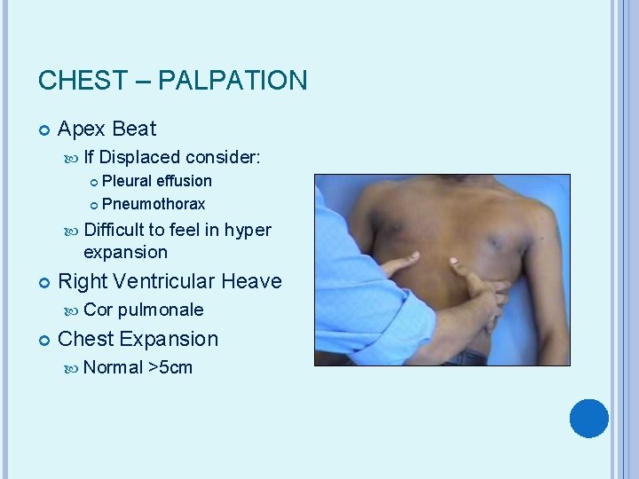 CHEST – PALPATION Apex Beat If Displaced consider: Pleural effusion Pneumothorax Difficult to feel