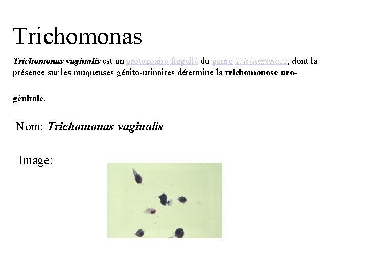 Trichomonas vaginalis est un protozoaire flagellé du genre Trichomonase, dont la présence sur les