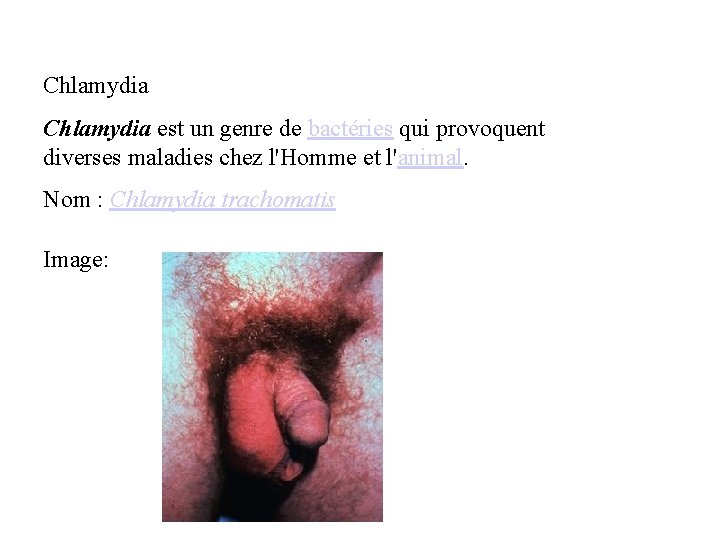 Chlamydia est un genre de bactéries qui provoquent diverses maladies chez l'Homme et l'animal.