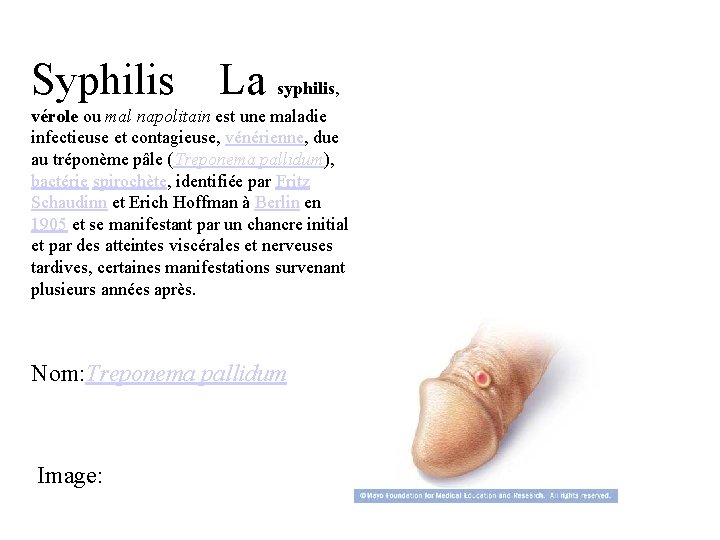 Syphilis La syphilis, vérole ou mal napolitain est une maladie infectieuse et contagieuse, vénérienne,