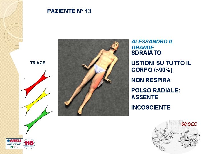 PAZIENTE N° 13 ALESSANDRO IL GRANDE SDRAIATO TRIAGE USTIONI SU TUTTO IL CORPO (