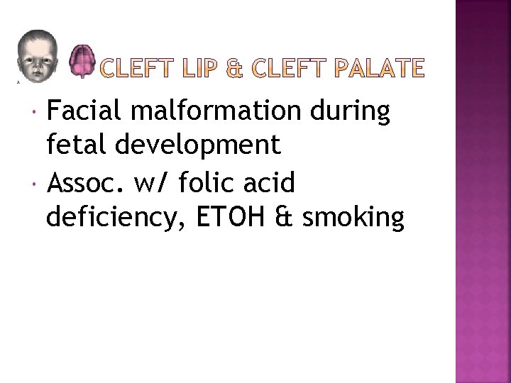  Facial malformation during fetal development Assoc. w/ folic acid deficiency, ETOH & smoking