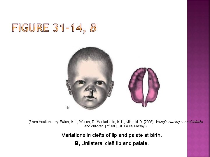 (From Hockenberry-Eaton, M. J. , Wilson, D. , Winkelstein, M. L. , Kline, M.