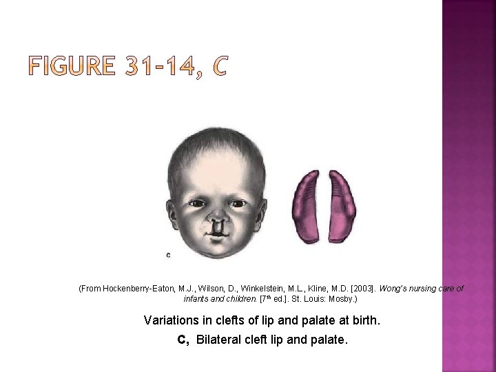 (From Hockenberry-Eaton, M. J. , Wilson, D. , Winkelstein, M. L. , Kline, M.