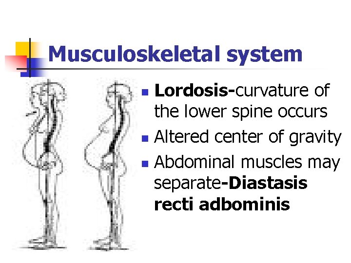 Musculoskeletal system Lordosis-curvature of the lower spine occurs n Altered center of gravity n