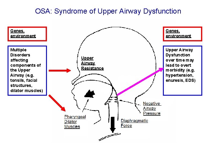 OSA: Syndrome of Upper Airway Dysfunction Genes, environment Multiple Disorders affecting components of the