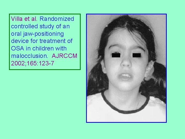 Villa et al. Randomized controlled study of an oral jaw-positioning device for treatment of