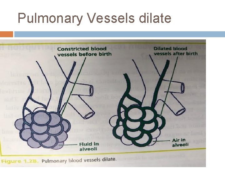 Pulmonary Vessels dilate 