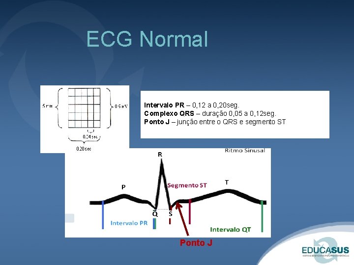 ECG Normal Intervalo PR – 0, 12 a 0, 20 seg. Complexo QRS –