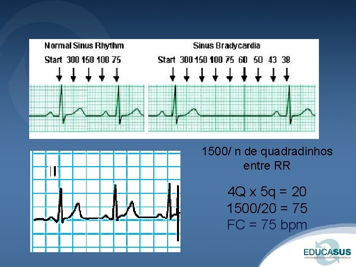 1500/ n de quadradinhos entre RR 4 Q x 5 q = 20 1500/20