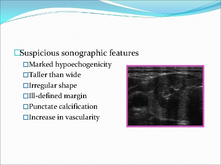 �Suspicious sonographic features �Marked hypoechogenicity �Taller than wide �Irregular shape �Ill-defined margin �Punctate calcification