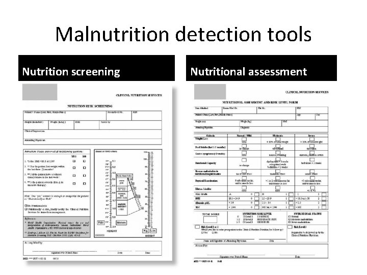 Malnutrition detection tools Nutrition screening Nutritional assessment Malnutrition detection tools Nutrition screening Nutritional assessment