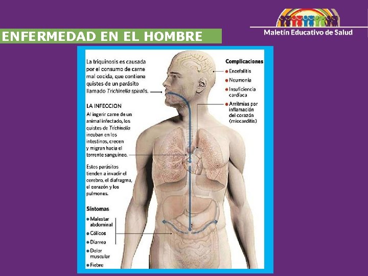 ENFERMEDAD EN EL HOMBRE 