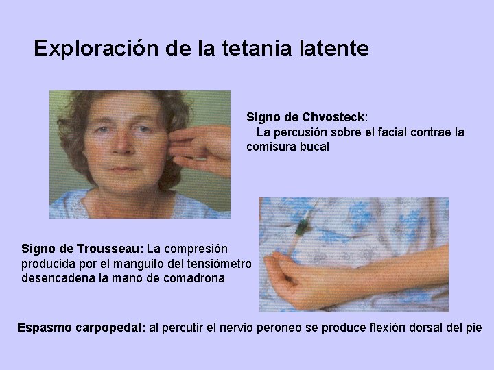 Exploración de la tetania latente Signo de Chvosteck: La percusión sobre el facial contrae