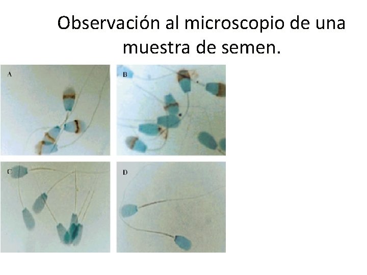 Observación al microscopio de una muestra de semen. Observación al microscopio de una muestra de semen.