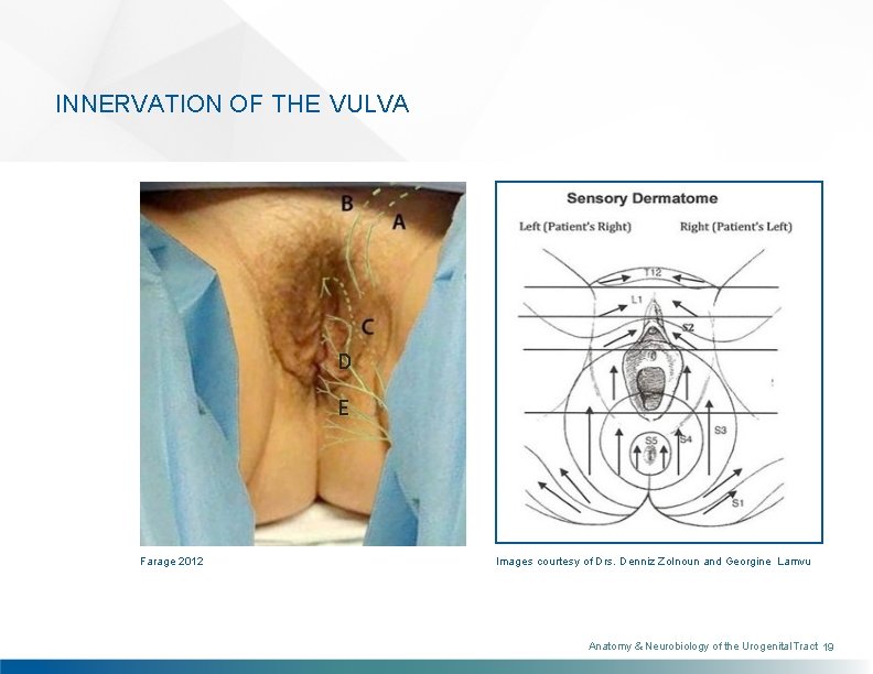 INNERVATION OF THE VULVA D E Farage 2012 Images courtesy of Drs. Denniz Zolnoun