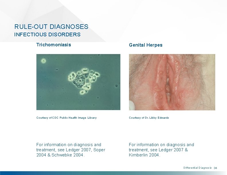 RULE-OUT DIAGNOSES INFECTIOUS DISORDERS Trichomoniasis Genital Herpes Courtesy of CDC Public Health Image Library