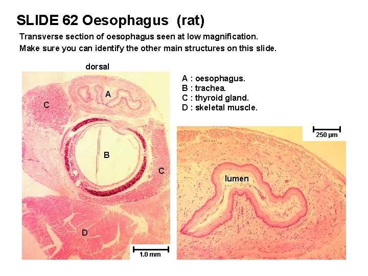 SLIDE 62 Oesophagus (rat) Transverse section of oesophagus seen at low magnification. Make sure