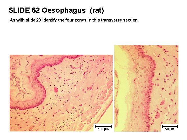SLIDE 62 Oesophagus (rat) As with slide 28 identify the four zones in this