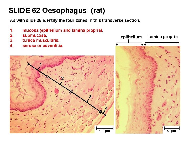 SLIDE 62 Oesophagus (rat) As with slide 28 identify the four zones in this