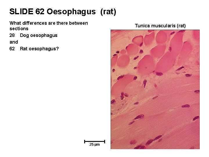 SLIDE 62 Oesophagus (rat) What differences are there between sections 28 Dog oesophagus and
