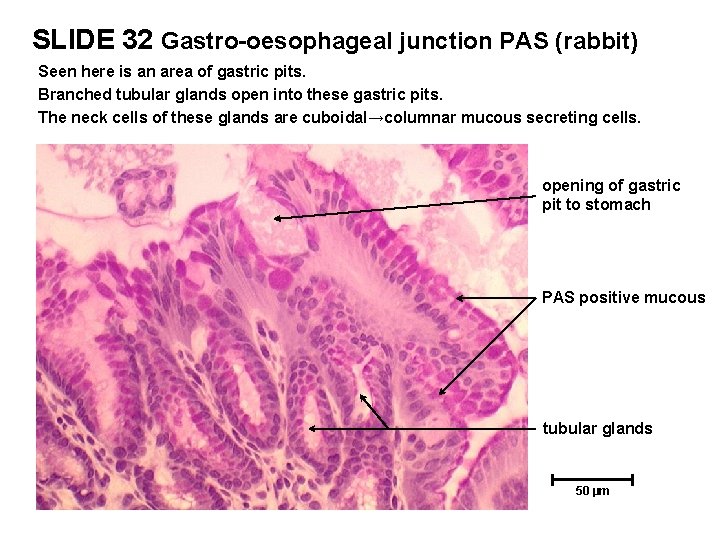 SLIDE 32 Gastro-oesophageal junction PAS (rabbit) Seen here is an area of gastric pits.