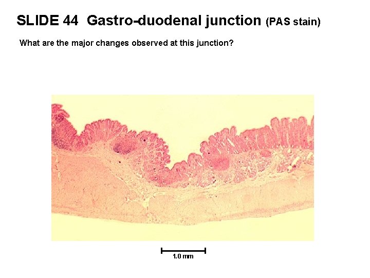 SLIDE 44 Gastro-duodenal junction (PAS stain) What are the major changes observed at this