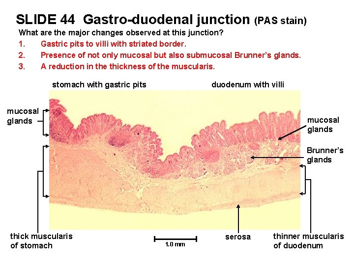 SLIDE 44 Gastro-duodenal junction (PAS stain) What are the major changes observed at this